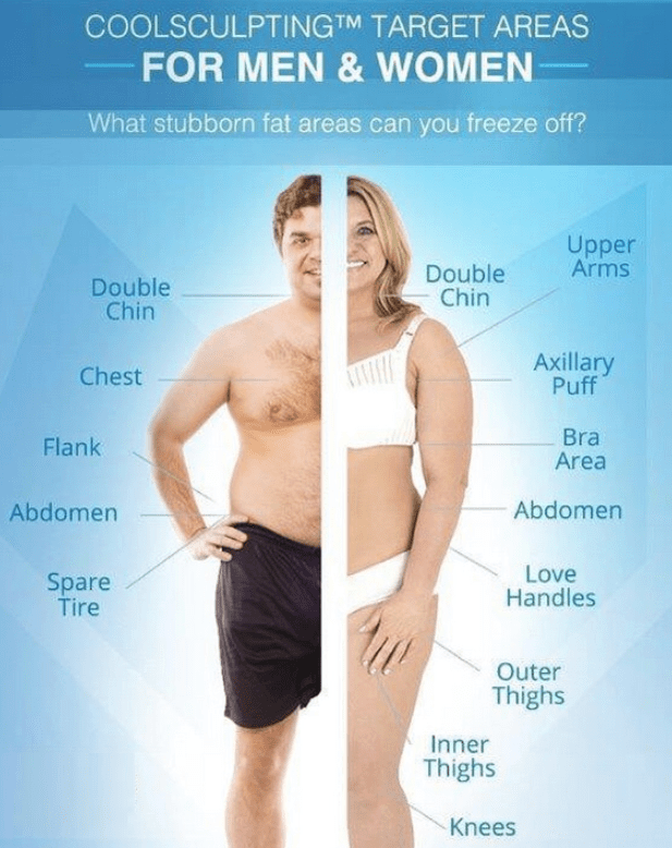 Dr-Salomon-CoolSculpting-Target-Areas-for-Men-and-Women